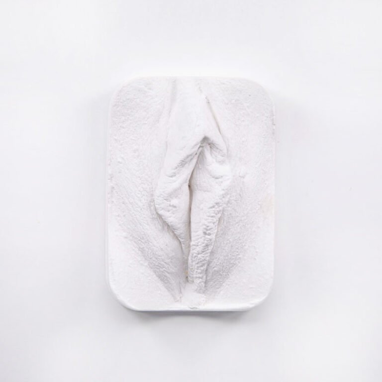 Vulva Gipsabdruck